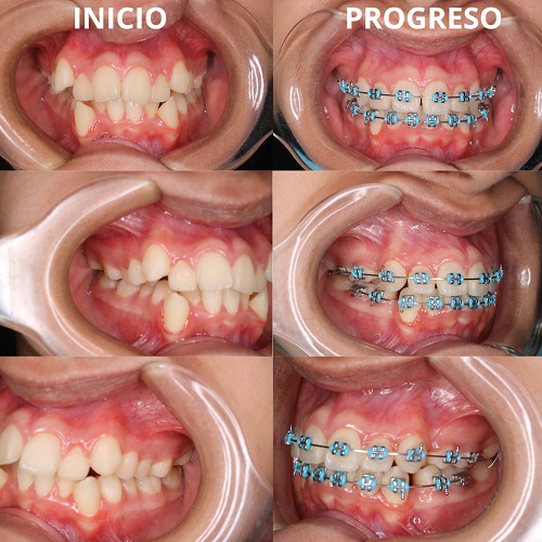 clinica dental en chiriqui