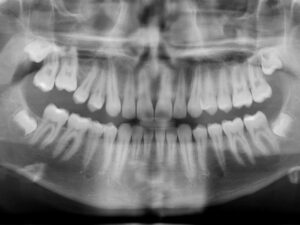 radiografia
